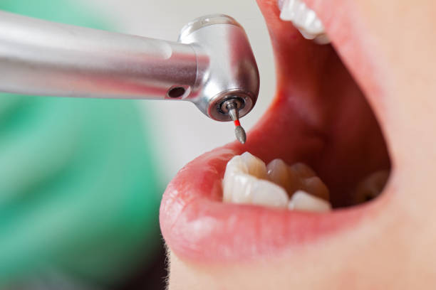 Best Emergency Care for Gum Disease in Upper Saddle River, NJ